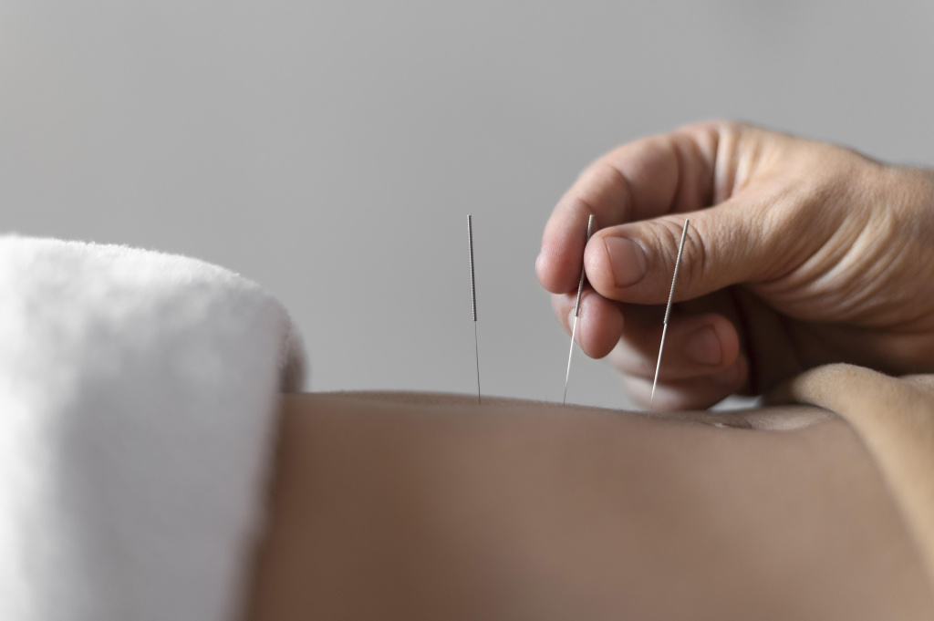 close-up-hand-holding-acupuncture-needle.jpg
